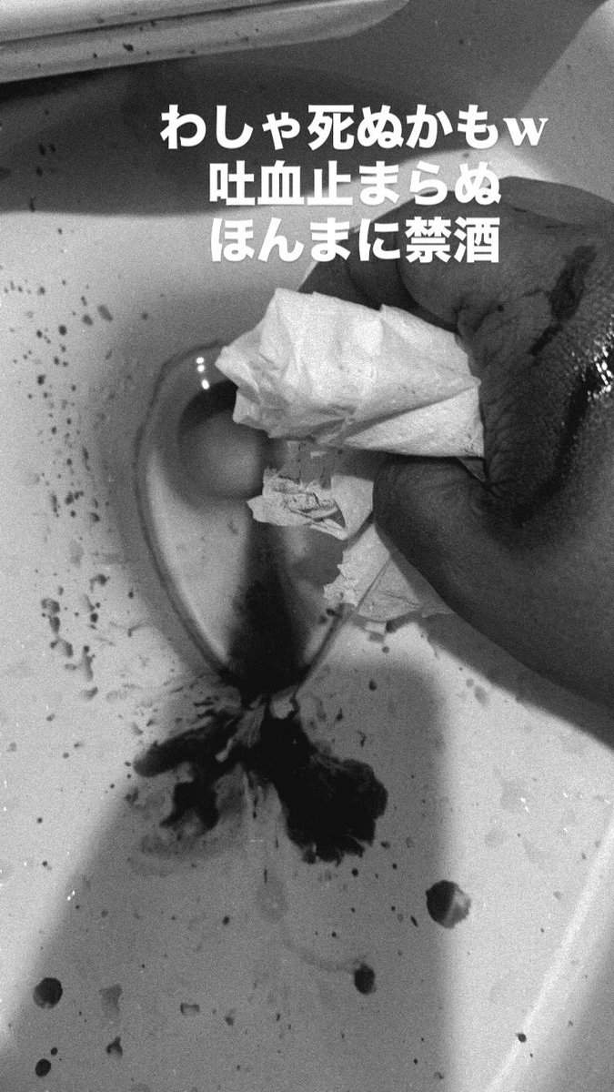 ryuchan08080's tweet photo. 最近吐血が止まらず
貧血、体調悪すぎるので
しばらく休みます https://t.co/XeSF2RlaNS