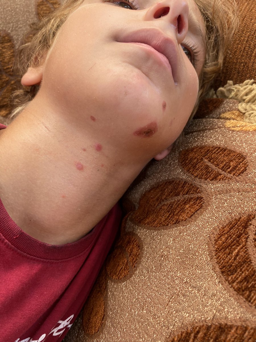 yousef_hosam7's tweet image. 🚨Share , Repost, we want to reach 300 comments please 🙏 

🔗 link in bio ☝️
🔗 PayPal : paypal.me/YousefFerwana?…