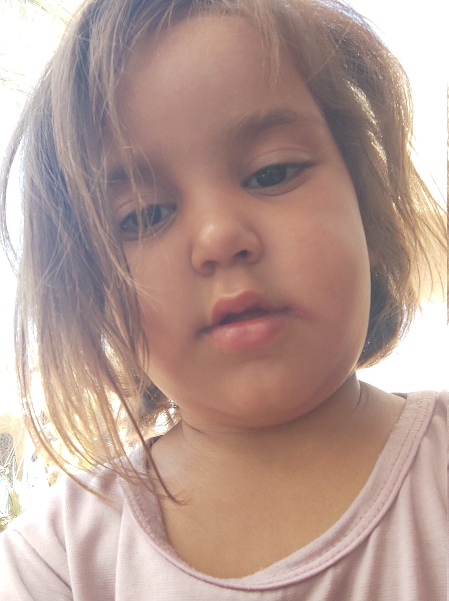 I'm disappointed. No donations, no support, no sharing. You've broken my heart and silenced my voice. If you're browsing, please leave a dot. It's just a dot.😭❤️❤️
chuffed.org/project/145189