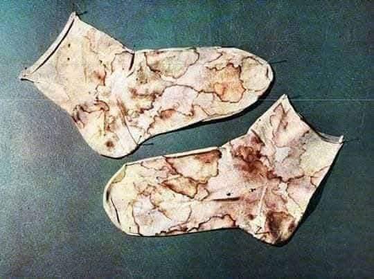 Photos of St Padre Pio's clothes stained with his blood from his stigmata.

As early as in 1910, the Lord singled Padre Pio out for that most significant of graces, the stigmata, i.e., a representation of his wounds. However, it was not until 20 September 1918 that the visible