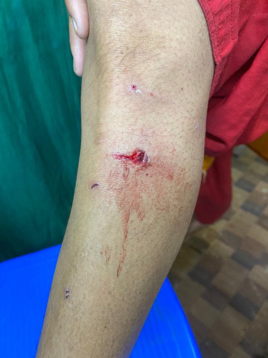 contactrazi's tweet photo. Week time. Kindly take immediate action . It has become a very dangerous situation to pass through the lane. Pls do the needful urgently before it attacks more children. @TelanganaCMO @TheNaveena @CoreenaSuares2 https://t.co/RBBHW481mM