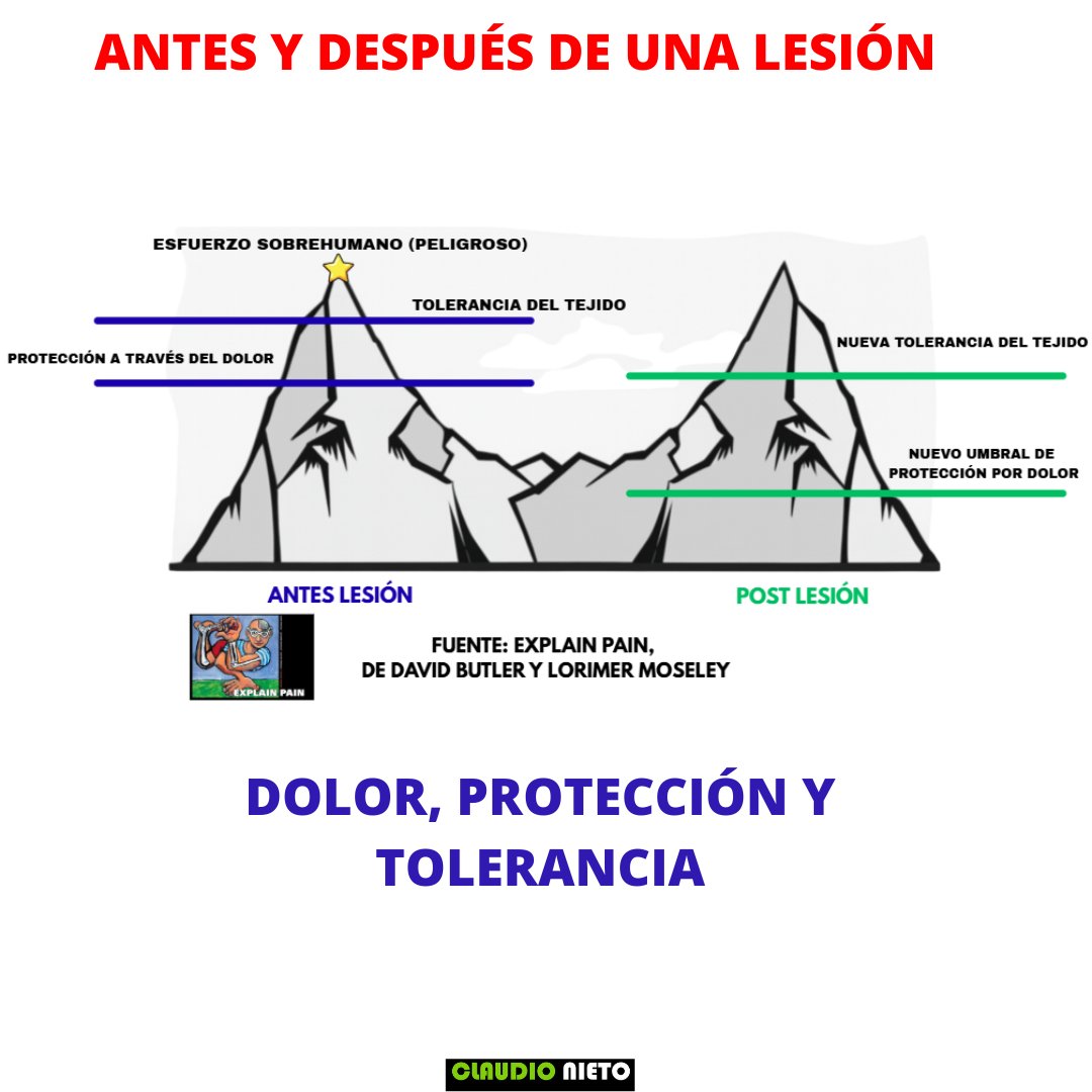 🔹 El dolor no siempre significa daño.
Cuando te lesionas, tu cuerpo activa un sistema de alarma para protegerte. Esa alarma (el dolor) puede aparecer mucho antes de que el tejido esté realmente en peligro.