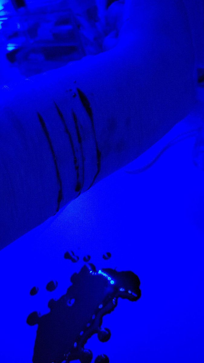mimom1315077's tweet photo. ああああ‼️生きててごめんなさい😿#selfharm　#自害  #자해 https://t.co/U58ICm2EBD