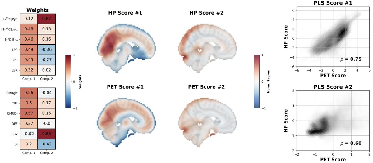 New paper in Imaging Neuroscience by Tyler Blazey, Cornelius von Morze, et al:

Spatial distribution of hyperpolarized [1-13C]pyruvate MRI and metabolic PET in the human brain

doi.org/10.1162/IMAG.a…