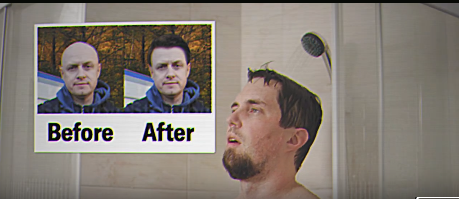 One #BioDAO project a day! <a href="/HairDAO_/">HairDAO 💈</a>  <a href="/BioProtocol/">Bio Protocol</a> 

HairDAO presents itself as an open-source R&amp;D network focused on hair loss treatments, where patients, researchers, and the broader community collaborate.  Participants can log their treatment experiences, propose and vote on