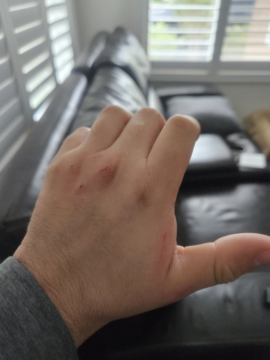 Web0z's tweet image. I feed a family of feral cats and one of them bit me when I tried to pet him/her 🥲