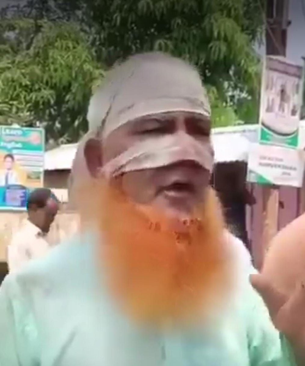 दुर्लभ तस्वीर 🦁
ज़ख़्मी "शेर" जिसकी नाक असम में लाठीचार्ज के दौरान चपटी हो गई।

क्या दाढ़ी का रंग देखकर इन्हें सच में शेर होने का भ्रम हो जाता है..? 🤔

#Assam #Sheer #AIMIM