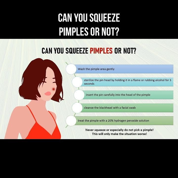 AllScientifical's tweet image. Can you squeeze pimples or not? #pimples #acne #skincare #cosmetics ... Continue to: youtube.com/watch?v=asq4F1…