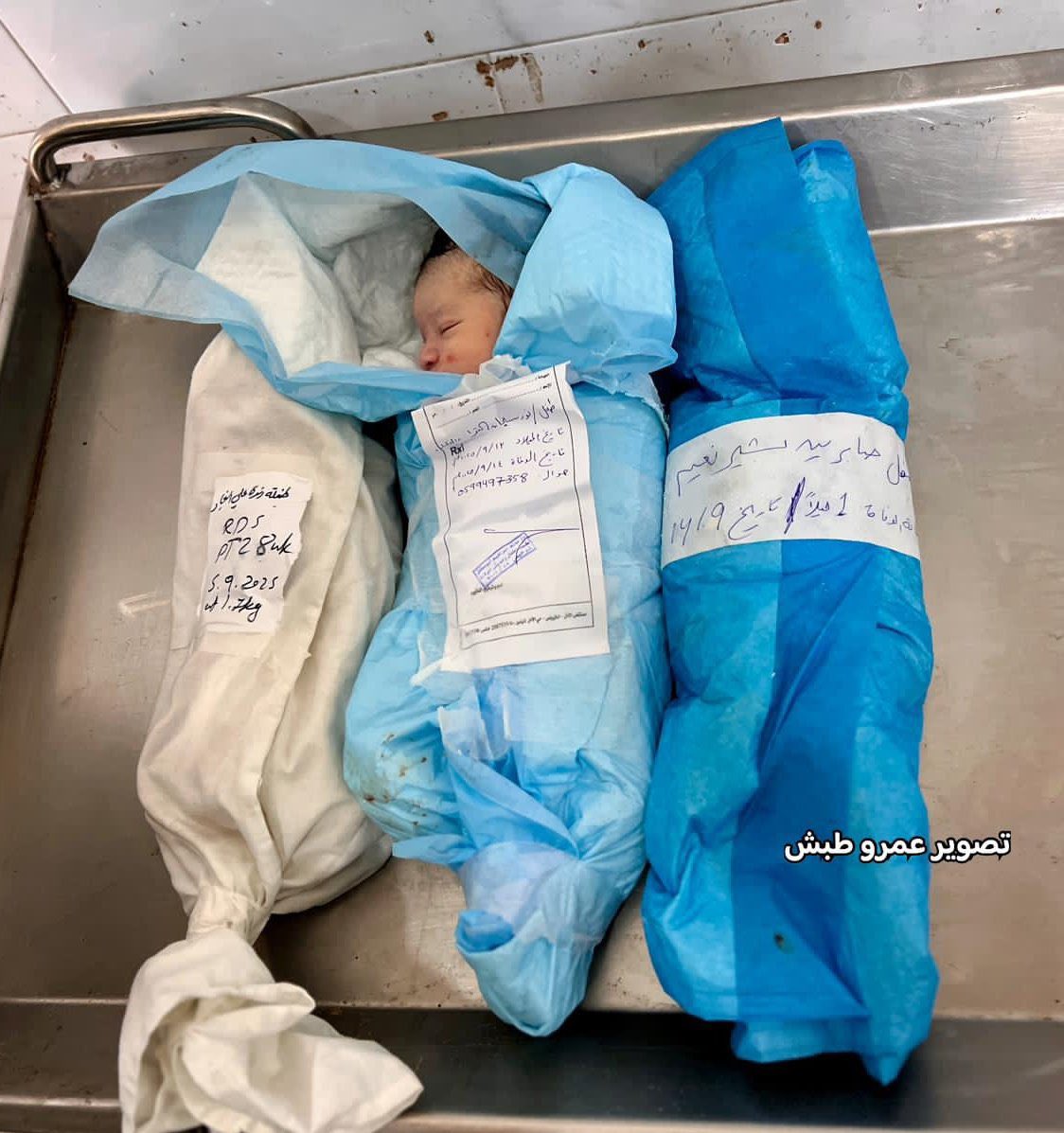 Gazze’li Küçük Melekler.

Bunu İsrail yaptı….

#WeAreSumud
 #SumuduKoruyun