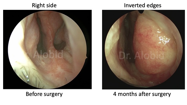 Dr. Isam Alobid tweet media