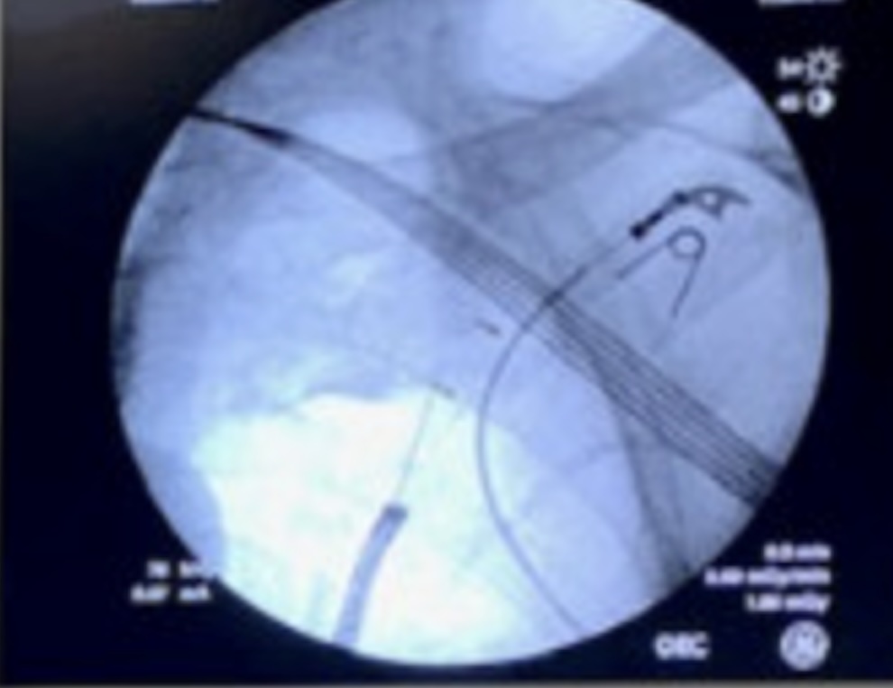 GS_Bronch tweet media