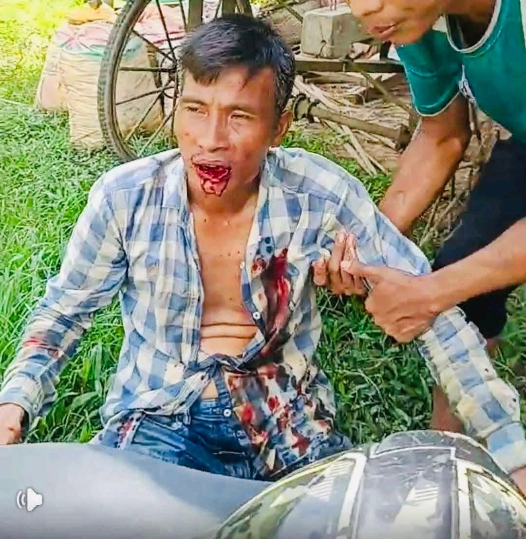 Junun Chakma tweet media