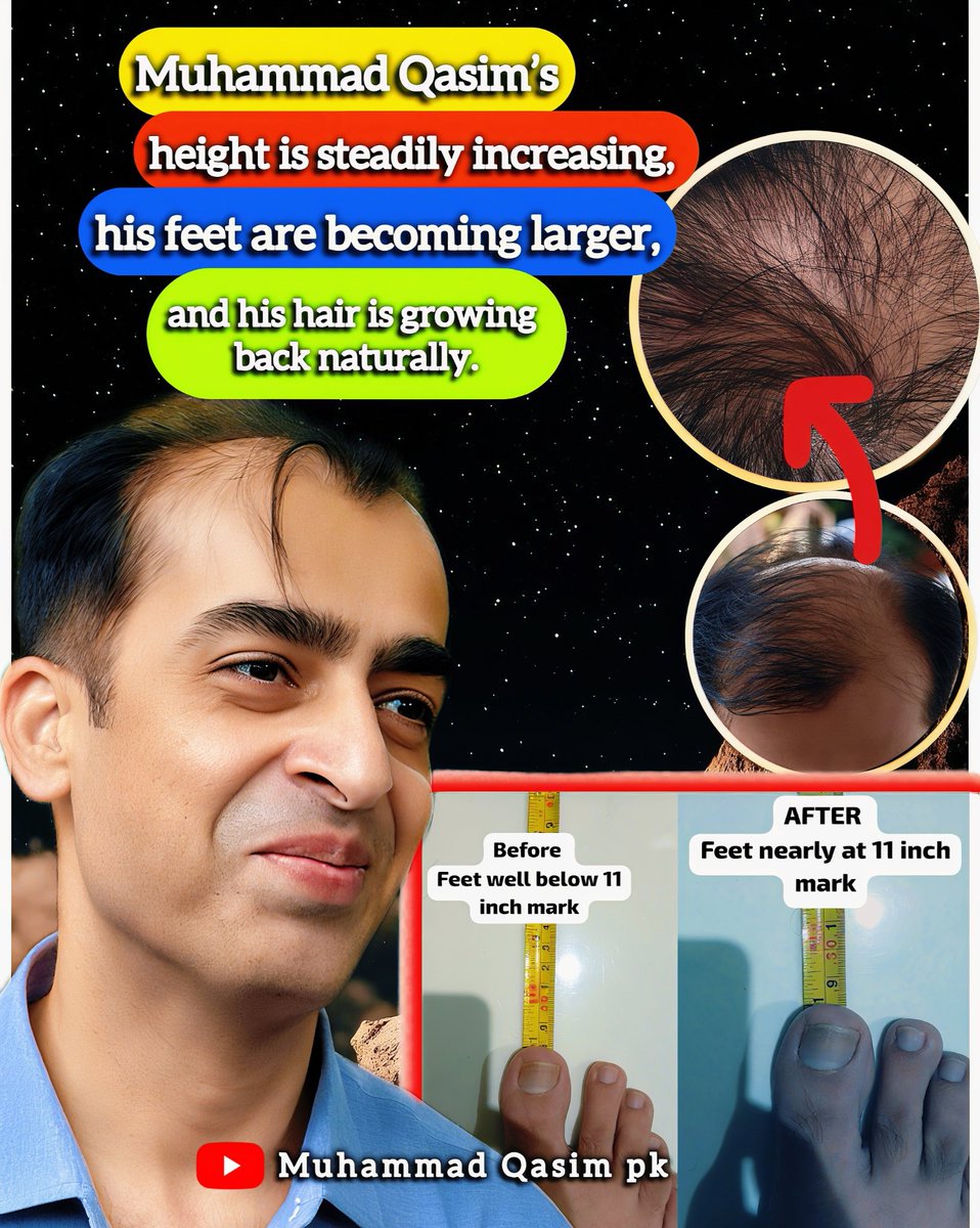 Hair grows back. Height increases. Strength develops. No science can explain this. But Qasim lives it every day. 
Amidst doubt, his body tells the truth. Qasim's transformation is a message we can no longer ignore. Muhammad Qasim