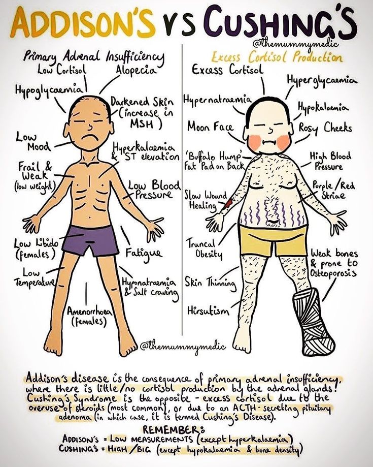 ADDISON VS. CUSHINGS