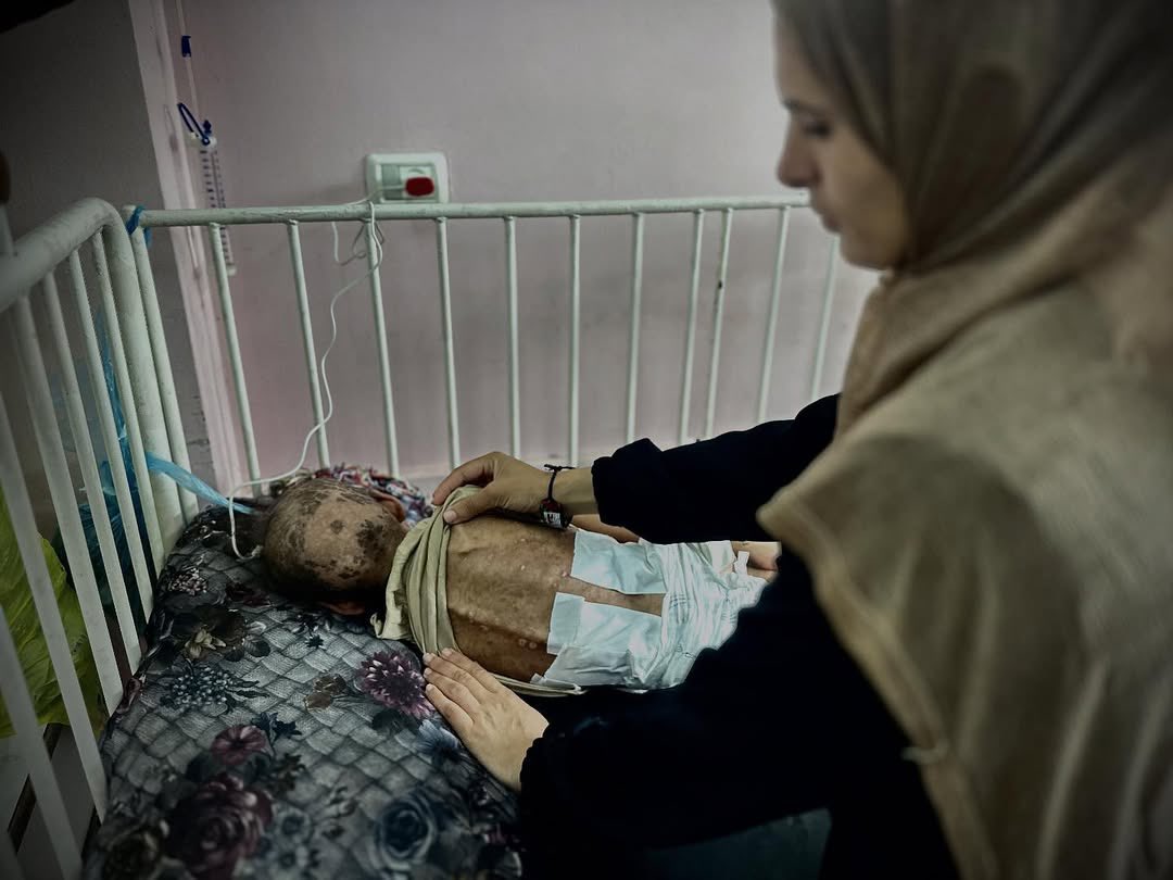 Timesofgaza's tweet image. Gaza children are suffering with no treatment.