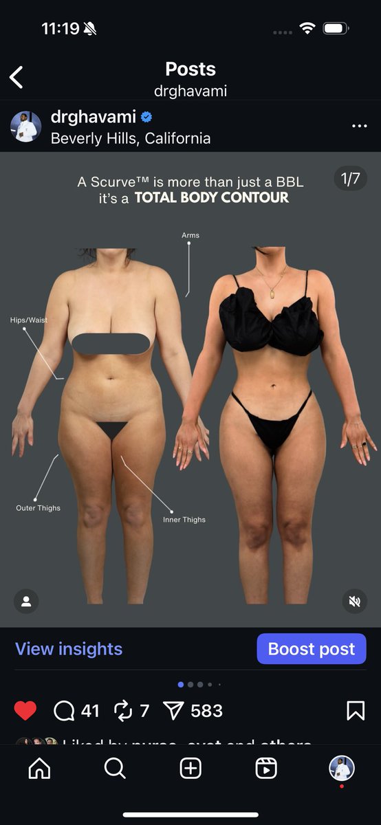 instagram.com/p/DPHJIGXkdDl/…