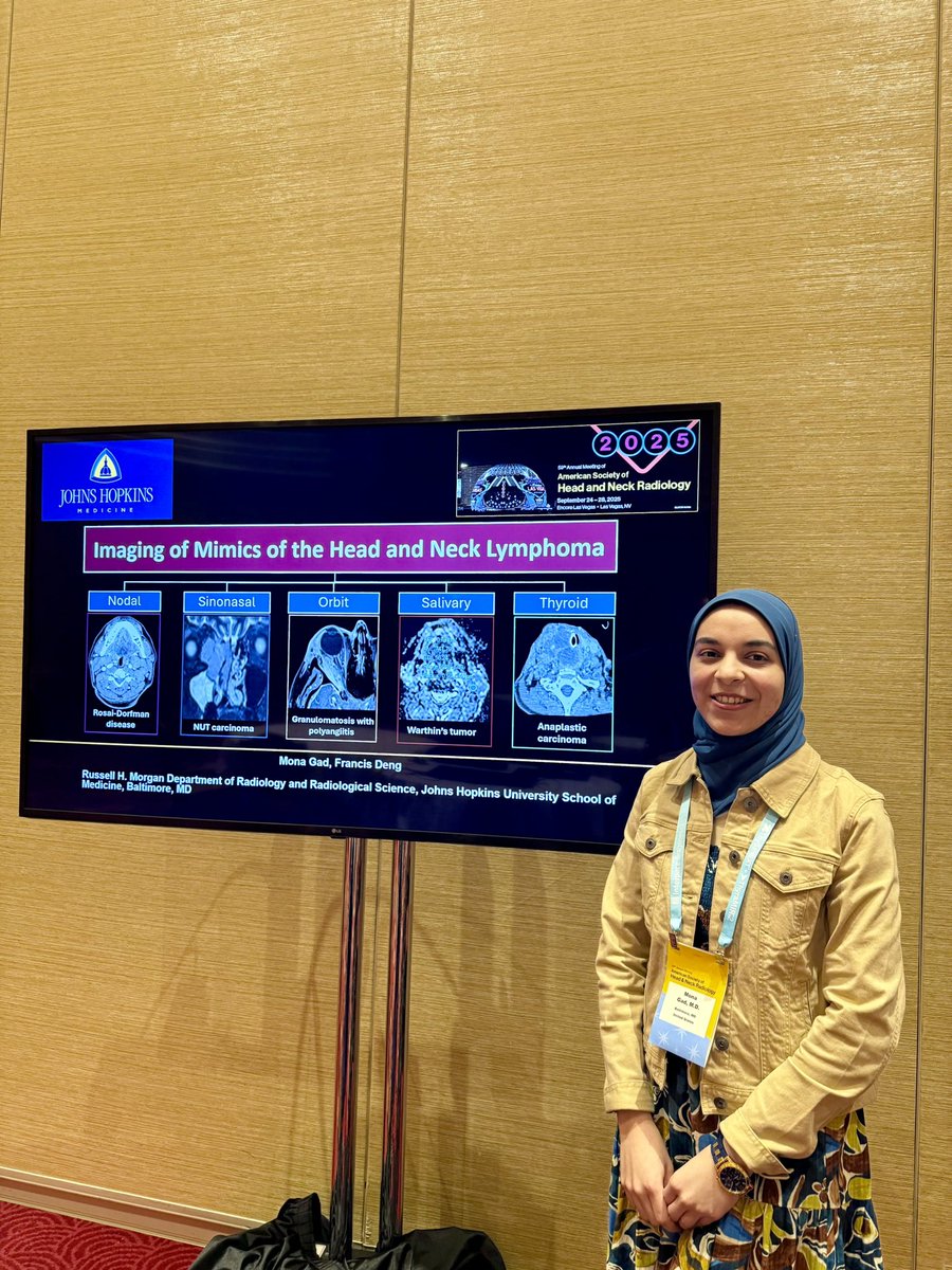 mona_gad_'s tweet photo. Had a great time at #ASHNR25 and grateful to contribute to this fantastic conference by an educational exhibit with my amazing mentor @francisdeng @ASHNRSociety @hopkinsneurorad https://t.co/Jnf8ohQmVI