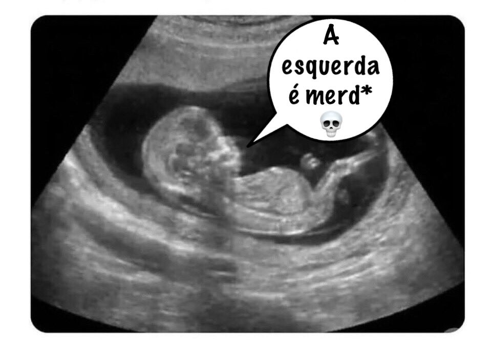 Deixo-vos uma imagem dos meus primeiros tempos de vida ❤️