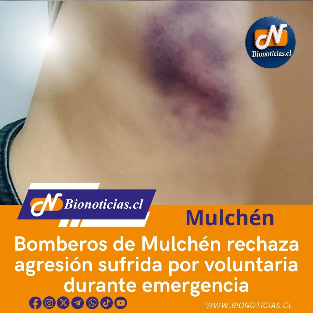 CHANDIAFER's tweet photo. Bomberos de Mulchén rechaza agresión sufrida por voluntaria durante emergencia
https://t.co/t4RYgEzadq 
#BomberosDeChile #Mulchén #RespetoBomberos #SeguridadComunitaria #NoMásViolencia https://t.co/nN3tUkewkU