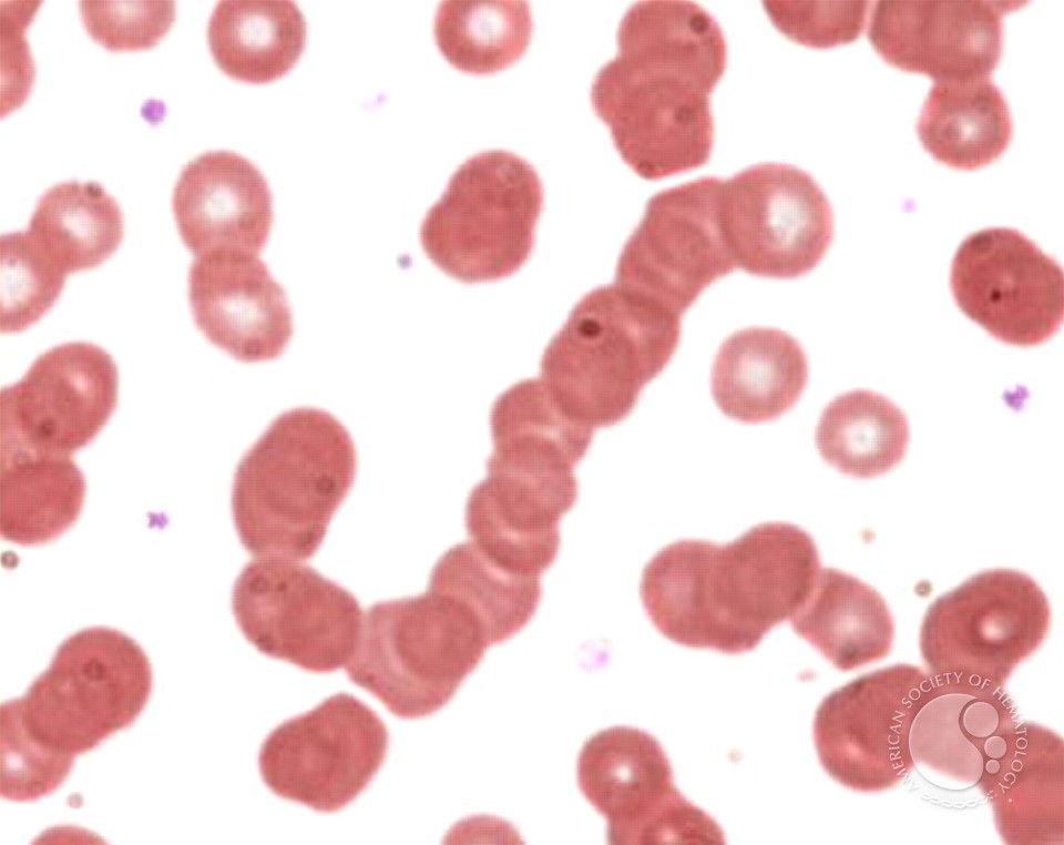 𝗡𝗶𝗵𝗮𝗿 𝗗𝗲𝘀𝗮𝗶 MD, DM tweet media