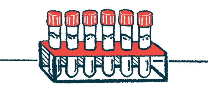 SclerodermaNews's tweet image. Self-reactive antibody level increases in the bloodstream after treatment is begun are associated with scleroderma progression, per a study. buff.ly/H0312Tg