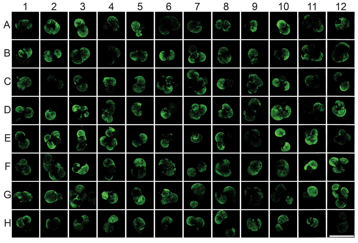 IOB_ch's tweet image. 🔬 Organoids in the spotlight!
Magdalena Renner, leading IOB’s organoid platform, shares how high-throughput organoid systems are transforming research and speeding up the path to therapies for eye diseases. Read more: bit.ly/4mquwjP
#Vision #HistoBrick #Blindness