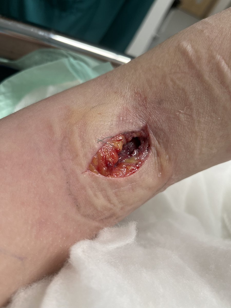 66aiz's tweet image. FAKE GORE
#shtwt