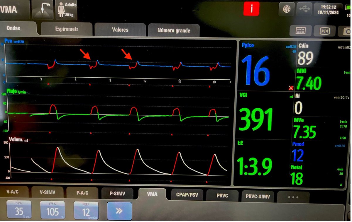 Journal of Mechanical Ventilation tweet media