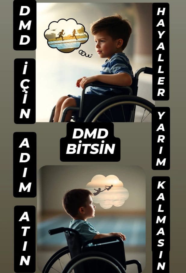 Givinostat ve Vamorolone yıllardır bekliyor! Bu çocukların zamanı yok! #DMDiçinAdımAtın  <a href="/saglikbakanligi/">T.C. Sağlık Bakanlığı</a> <a href="/drmemisoglu/">Prof. Dr. Kemal Memişoğlu</a> <a href="/suayipbirinci/">Doç. Dr. Şuayıp Birinci</a> <a href="/DrYerebakan/">Dr. Halit Yerebakan</a> 
<a href="/RTErdogan/">Recep Tayyip Erdoğan</a> <a href="/dbdevletbahceli/">Devlet Bahçeli</a>