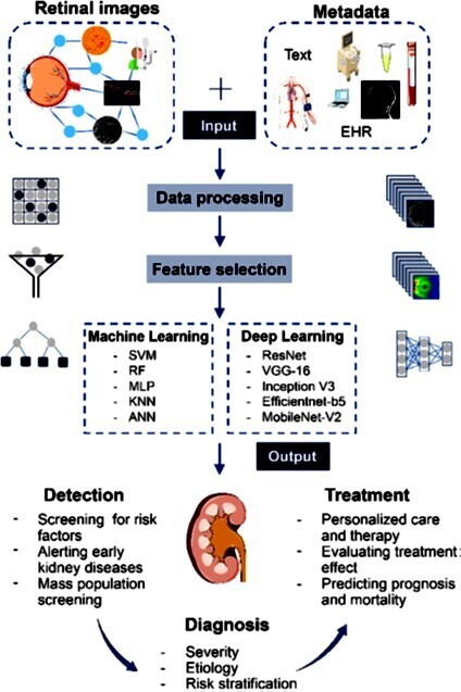IA : maladies rénales et l'oeil  medvasc.info/archives-blog/… <a href="/zambo57/">Paolo Zamboni</a> <a href="/JZefka/">Jo Zefka</a> <a href="/ZeClint/">Ze Clint</a> <a href="/zudenstein/">Geraldine POENOU</a> <a href="/zemblanity00/">J.A. Betancourt Rodríguez</a> <a href="/szuily/">Stéphane ZUILY</a> <a href="/LyndaAzzouz2/">Lynda Azzouz</a> <a href="/AfakNsiri/">Afak Nsiri</a> <a href="/afintmedvasc/">Association Française Internes Médecine Vasculaire</a> <a href="/EtienneKlein/">Etienne KLEIN</a> <a href="/ErinMichos/">Erin D. Michos, M.D.</a> <a href="/EricBillyFR/">Eric Billy 🇫🇷🇪🇺🦋</a> <a href="/EzzakiKhalil/">Ezzaki Khalil</a> <a href="/emnahammamihema/">emna hammami</a> <a href="/ValdelievreE/">Emilie Valdelievre</a> <a href="/ellto38/">YoannH</a> <a href="/EricTopol/">Eric Topol</a> <a href="/ESVM_/">European Society of Vascular Medicine</a> <a href="/SCVE_fr/">Chirurgie Vasculaire</a>