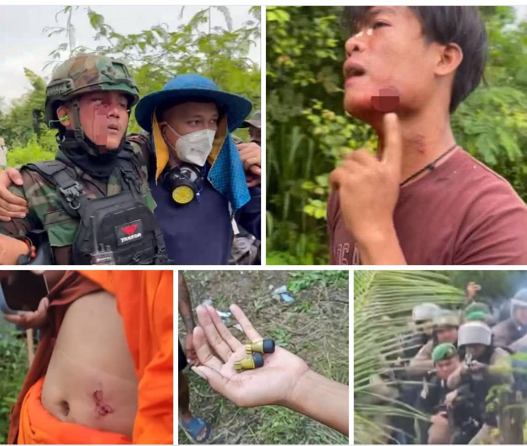 rothofficial99's tweet photo. Breaking News ‼️ 
Nearly 10 Cambodian citizens, monks, soldiers, and police officers were seriously injured in a clash with Thai soldiers in Prey Chan village, O Bei Choan commune, O Chrov district, Banteay Meanchey province on the afternoon of September 17, 2025. https://t.co/dvnserUJBQ