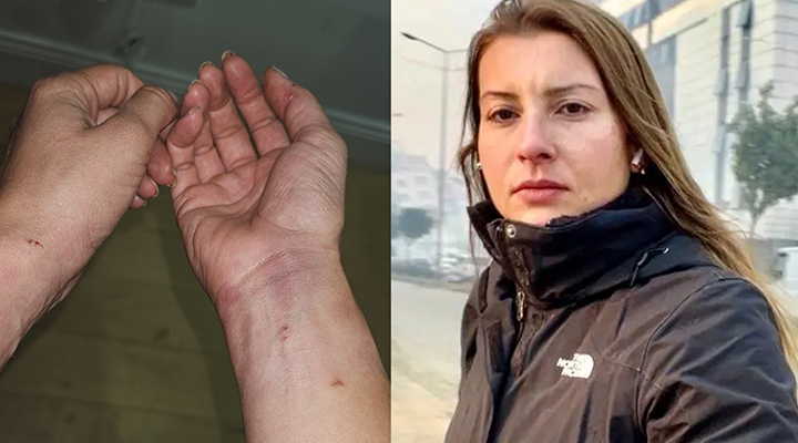 Gazeteci Neyran Elden polisler tarafından darp edildi
gazetepatika23.com/gazeteci-neyra…