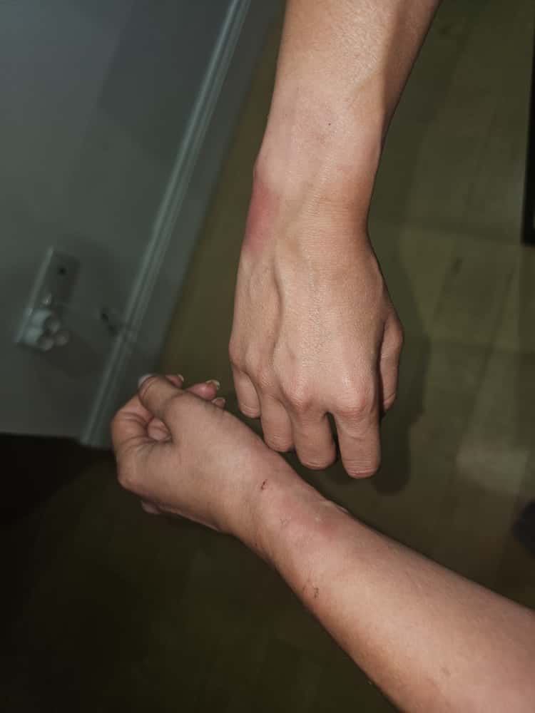 neyranelden's tweet image. Dün akşam inanmakta hala güçlük çektiğimiz kan dondurucu bir olay yaşandı. Evimize polis geldi. Beni ve eşimi darp ettiler. Bana kelepçe taktılar ve evin içine zorla girerek benim gözüme biber gazı sıktılar. Hiçbir hukuki dayanakları yoktu. Detayları anlatıyorum.