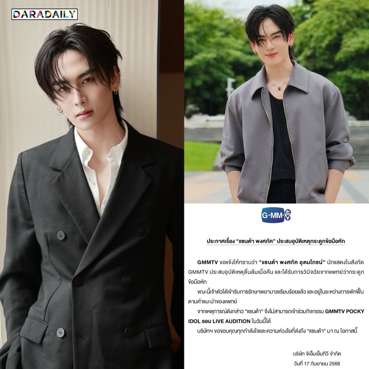 GMMTV ร่อนแถลงการณ์ “แซนต้า พงศภัค” ลื่นล้ม แพทย์วินิจฉัยกระดูกข้อมือหัก เข้ารับการรักษาเรียบร้อยแล้ว 💪🏼🤟🏻🥹

ส่งกำลังใจให้คูมแซนต้านะค้าบบบ หายไวๆน๊าาา 💪🏼🤟🏻

Cr. IG : santa.pp / GMMTV

#Santapp #แซนต้าพงศภัค #GMMTV #daradaily #ดาราเดลี่ #ข่าวบันเทิง