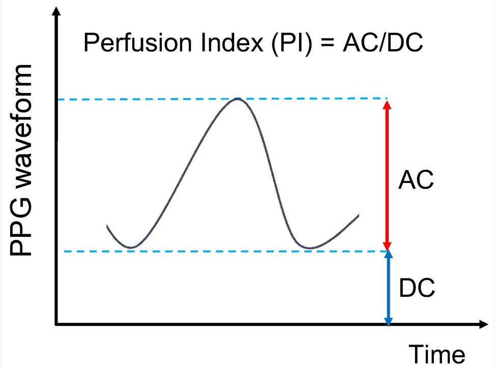 Sensors_MDPI's tweet image. The Development of a Measuring System for Intraoral SpO2
mdpi.com/1424-8220/24/2…
#pulse_oximetry #mouthpiece