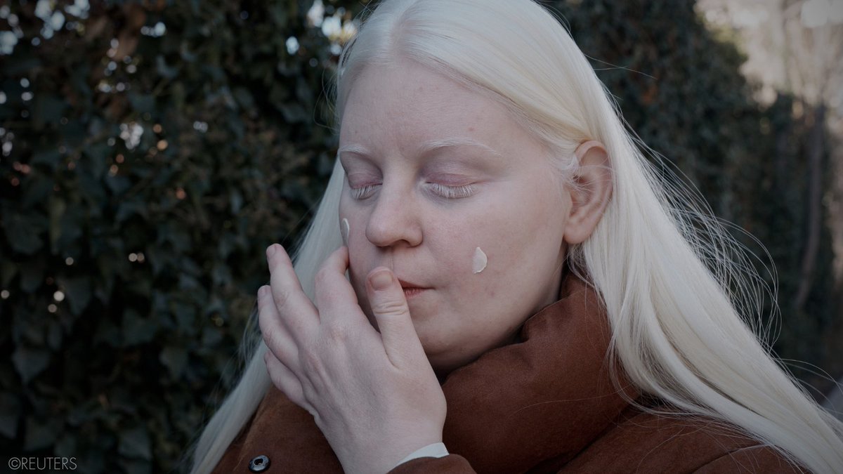 UN_SPExperts's tweet image. UN experts @UnAlbinism &amp;amp; @SRclimatechange welcome @WHO decision to add sunscreen to model lists of essential medicines - an important development to draw attention to &amp;amp; find remedies for the needless deaths caused by skin cancer for persons with #albinism.
ohchr.org/en/press-relea…