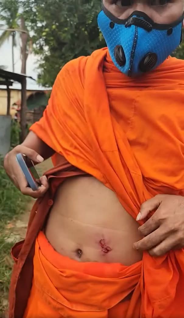 M76275Me's tweet image. 据信息部消息，2025年9月17日下午，泰国士兵手持盾牌、警棍和武器，继续侵犯柬埔寨领土。他们在班迭棉吉省乌触县奥比春乡的Prey Chan村继续架设铁丝网，并使用催泪瓦斯、弹弓和高频噪音设备攻击柬埔寨公民，导致包括僧侣在内的多名公民受伤。
柬埔寨军队严格遵守停火协议，在场保卫我国人民的安全。