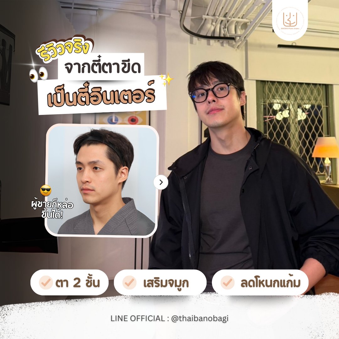 banobagithai's tweet image. เปลี่ยนลุค!
จากหนุ่มตี๋ตาขีด &amp;gt;&amp;gt; เป็นหนุ่มตี๋อินเตอร์ 🤩✨

รีวิวจริง จากคุณเฮง หนุ่มตี๋ของบาโนบากิ
ทำรายการอะไรไปบ้าง มาดู 👀

#banobagi #บาโนบากิ  #โครงหน้า #ตาสองชั้น #เสริมจมูก  #งานปรึกษาศัลยกรรม #ศัลยกรรมเกาหลี #โปรโมชั่น