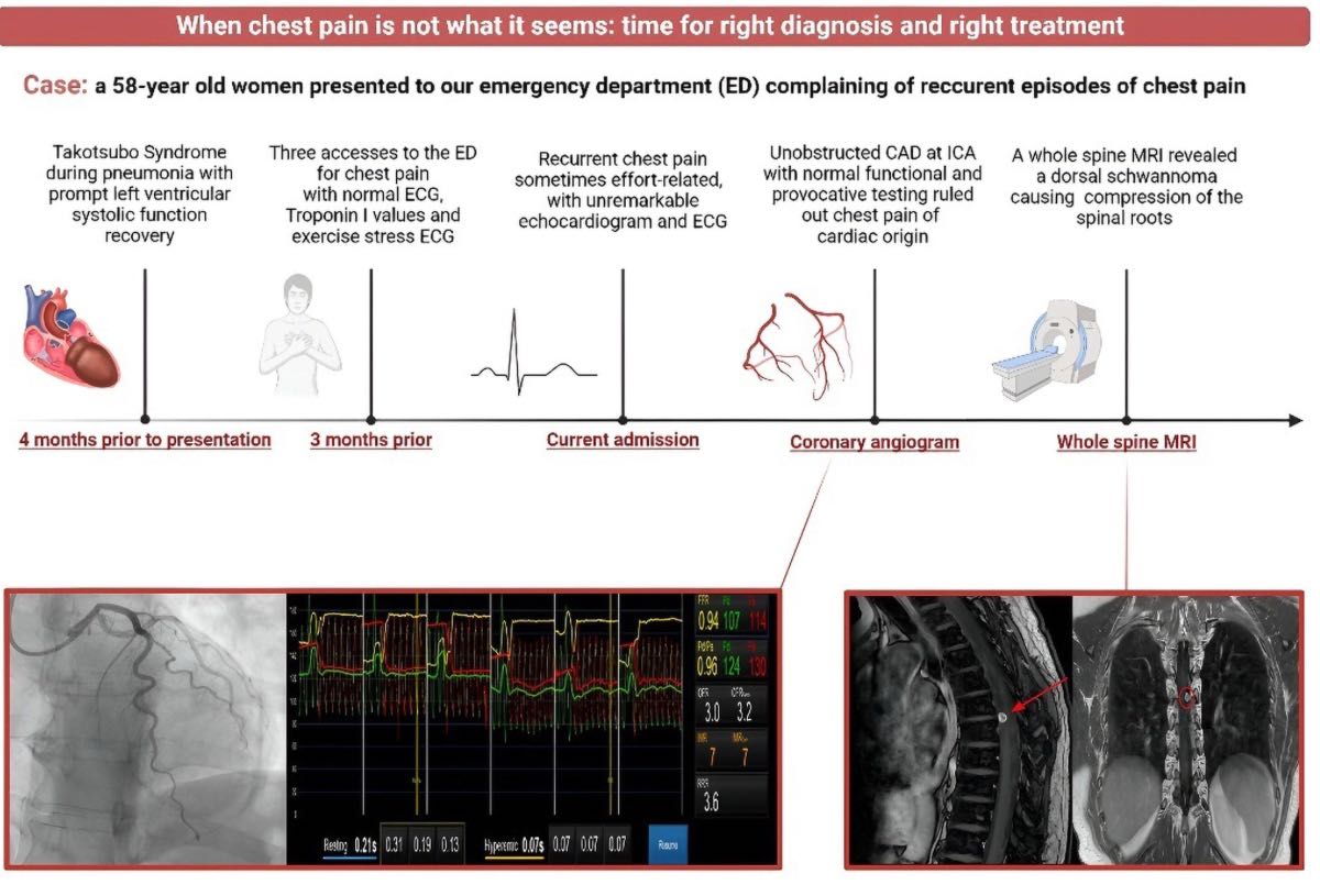 ESC_Journals's tweet image. When chest pain misleads: The importance of right diagnosis and treatment—A case report  ow.ly/y6an50WWNYm

#EHJCaseReports @Phiso_de @TJ_Yeo @aayshacader @BoldiKovacsMD @KardiologieHH @ANazmiCalik @O_Azizy_MD @saramoscatelli7 @EHJCREiC #CardioX #EPeeps