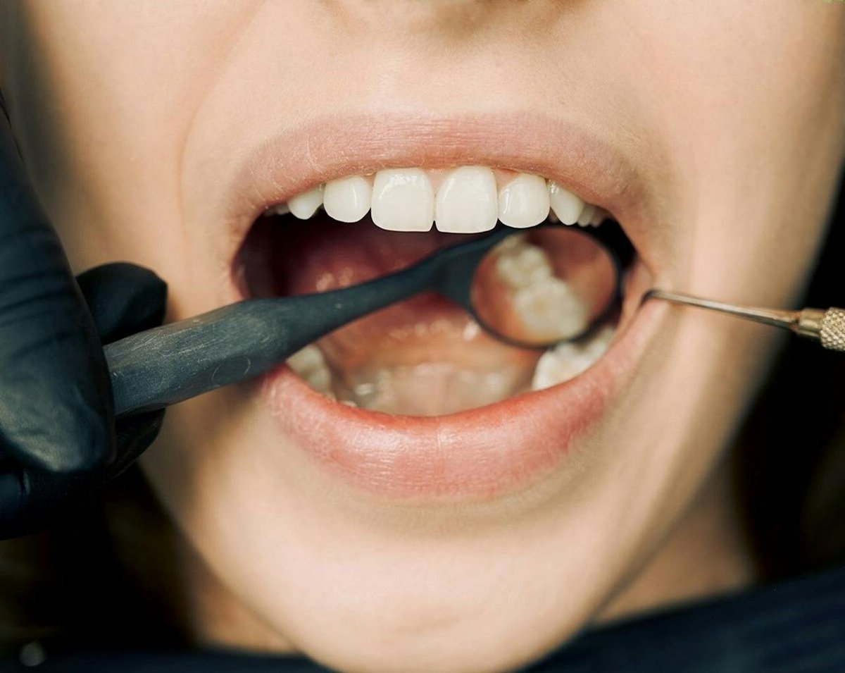 How Soon Can I Eat After a Dental Filling?

ow.ly/tm4H50WWXW9
#dentalfilling #cavities #dentistry #dentalcare