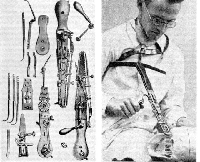 Rainmaker1973's tweet photo. The first chainsaw was developed in 1780 by Scottish doctors John Aitken and James Jeffray to assist with childbirth. 

Before C-sections were a thing, doctors would use chainsaws to cut through parts of the woman’s pelvic bones and cartilage in order to make space for the baby. https://t.co/dHXXSFOuMj