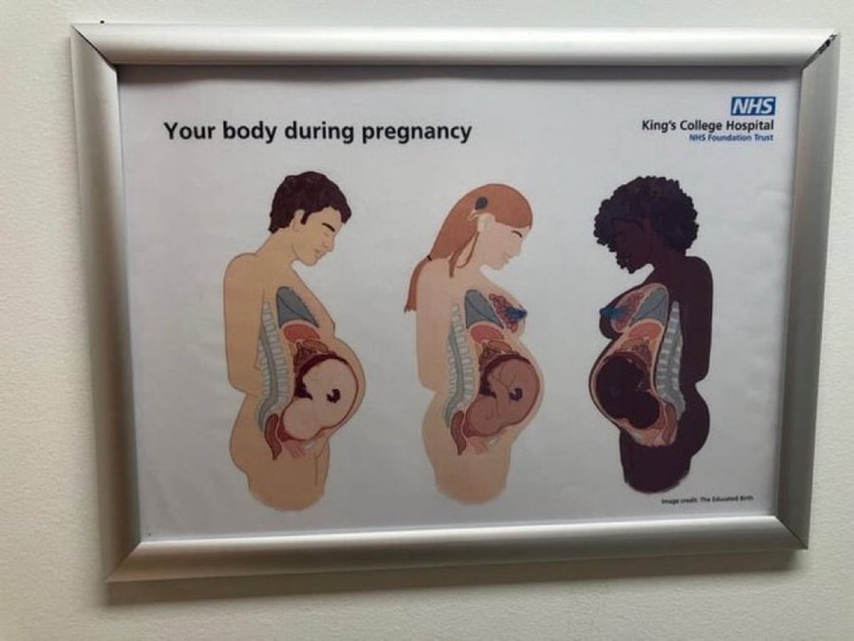 JoeyMannarinoUS's tweet image. This is up in the NHS in the UK.
Taxpayers paid to print this.
What in the world has happened to the UK?