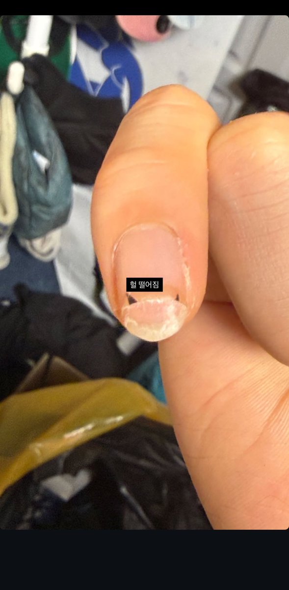 방정리하다가 떨어졌나봥ㅠㅠㅠㅜㅠ