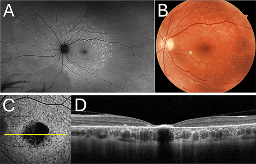 TVST Journal tweet media