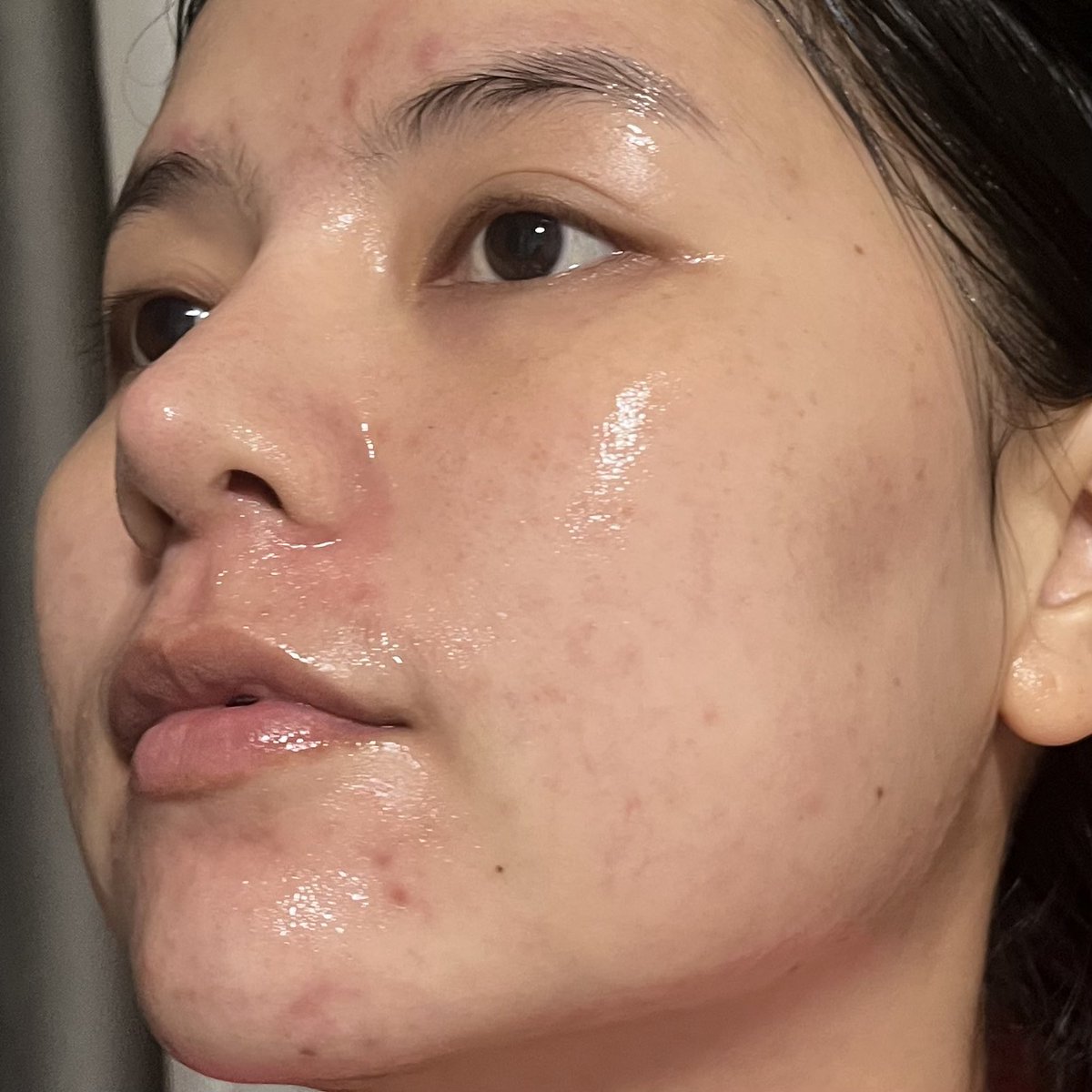 imwntn_'s tweet image. แกรรร ฟังนะ มากส์อันนี้ดีมากกก #Earthlab ไวท์เทนนิ่ง ซีรั่ม มากส์ ซองแดง ที่ให้ทั้งความชุ่มชื้นและความกระจ่างใส เนื้อเซรั่มฉ่ำมาก หลังมาส์กรู้สึกเลยว่าผิวอิ่มน้ำสุดๆ มาส์กก่อนนอน เช้าแต่งหน้าง่ายขึ้นเยอะ ไม่เป็นคราบเลย ใครที่แต่งหน้าแล้วหยือ ลองเอาไปมาส์กก่อนแต่งหน้าดูนะ…