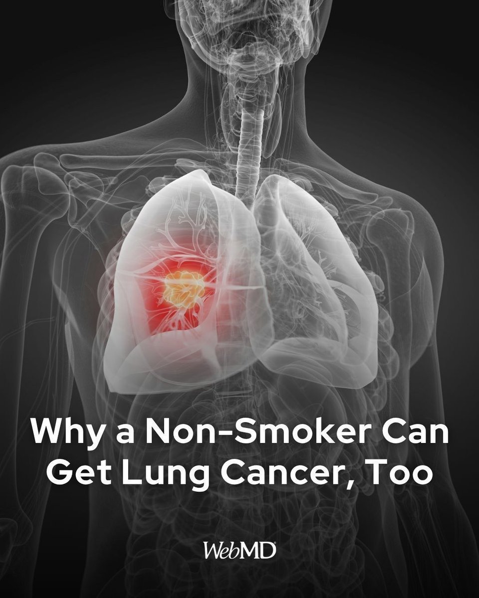 TheHealthHubrmc's tweet image. 👉🏼 Why a Non-Smoker Can Get Lung Cancer, Too: buff.ly/nBKOTgc
#WebMD #lungcancer