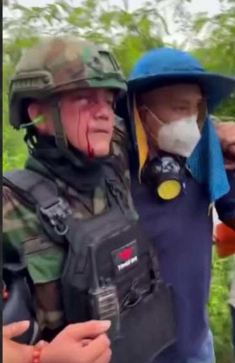 FairyCuddle's tweet photo. 17/9/2025 Thai soldiers use all kinds of weapons like gun, bomb, poison gas wires to invaded Cambodian territory in order to take over Cambodia land while Cambodian soldiers and civilians didn’t have any weapons just use their hands to defend.

#ThailandViolatestheceasefire https://t.co/AK6VRa6cqx