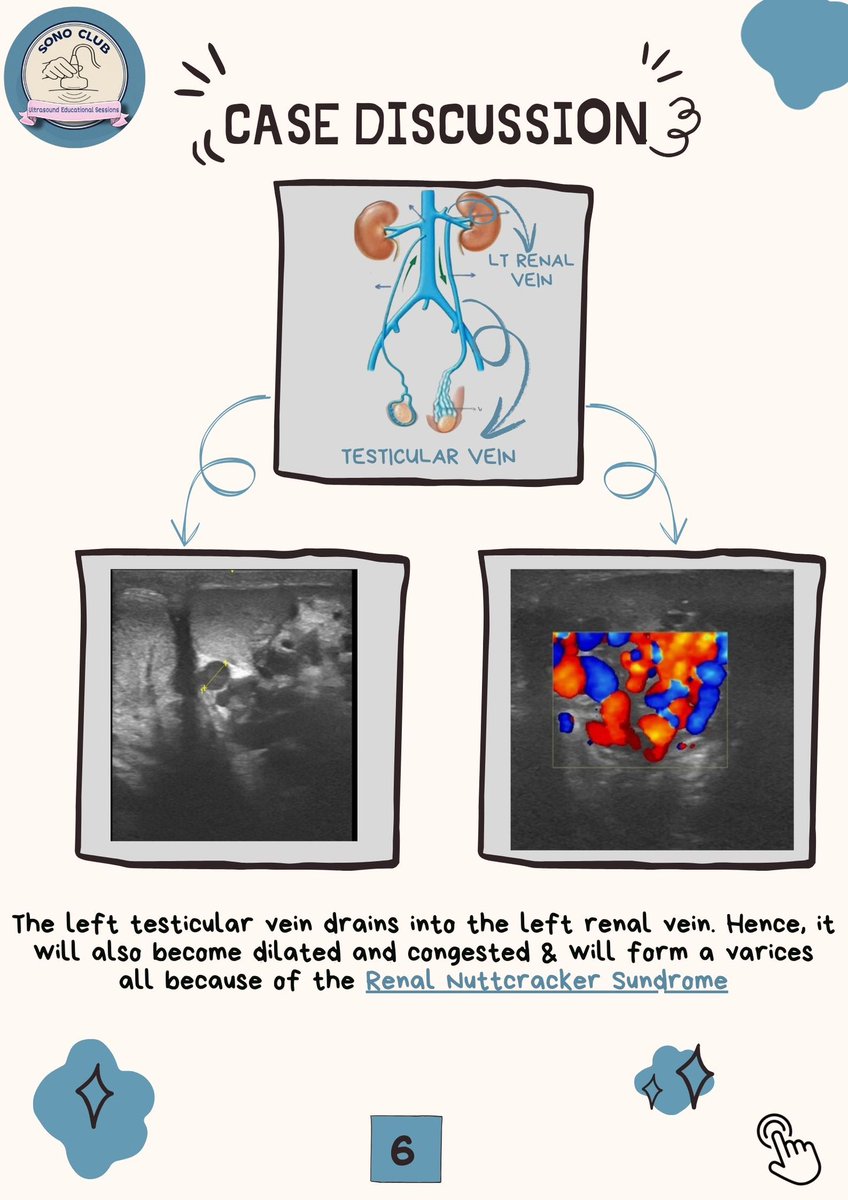 SonoClubsa's tweet photo. 📸 Swipe to see how ultrasound and imaging techniques assist in diagnosing this syndrome! https://t.co/ycgjU0ePdd