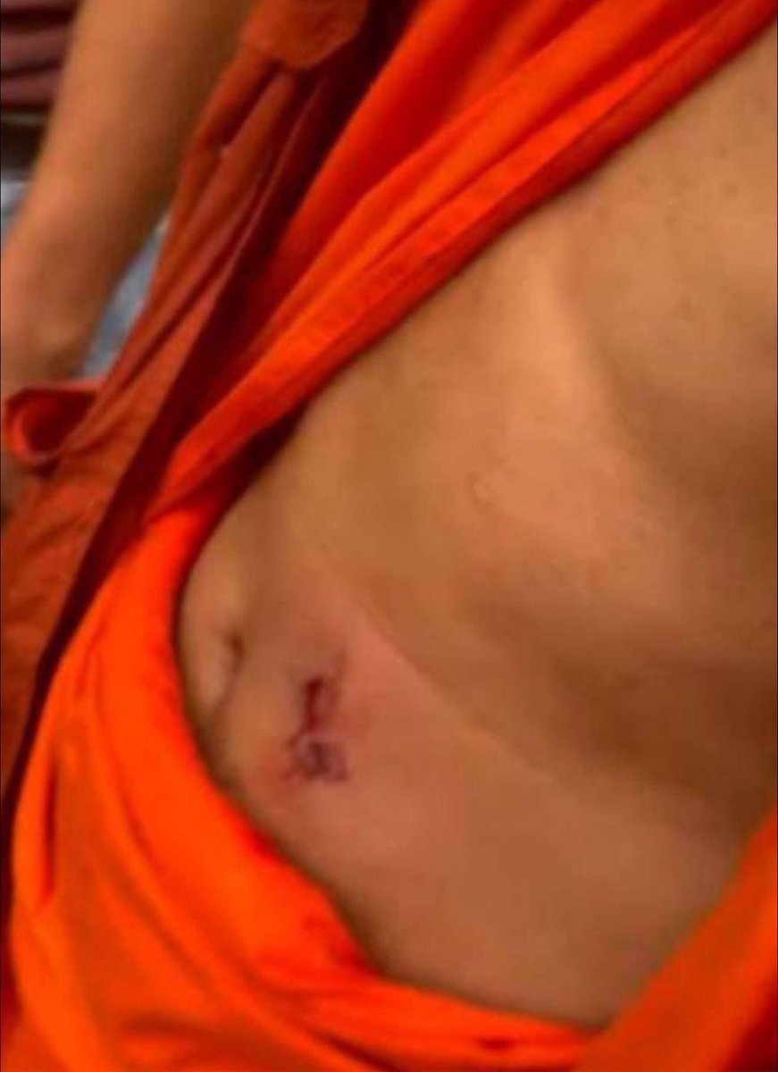 Kai_v004's tweet photo. Ceasefire? Yet today Thai forces invaded Prey Chan, Cambodia — firing at our civilians, even injuring a monk. Cambodia chooses peace, but how long must our people suffer in their own homes? #Cambodianeedpeace #JusticeForCambodia https://t.co/Uh1teG3yfx