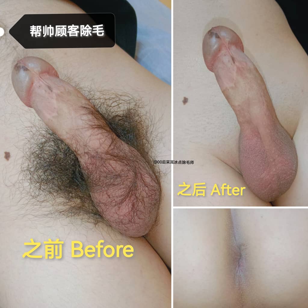 00后采耳冰点除毛师的（备用号） tweet media